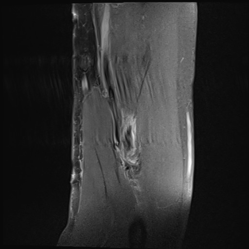 Click on the Serie image to view the images of Wieszt, Gnter